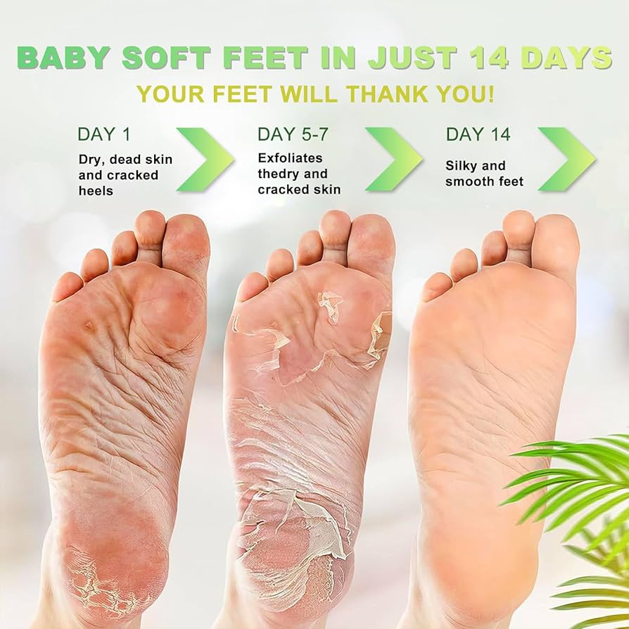 CELAVI EXFOLIATING FOOT PEELING MASK ALOE, 45944